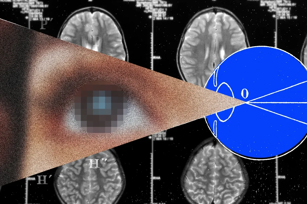 science-brain-implant-vision.webp
