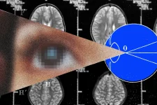 science-brain-implant-vision.webp